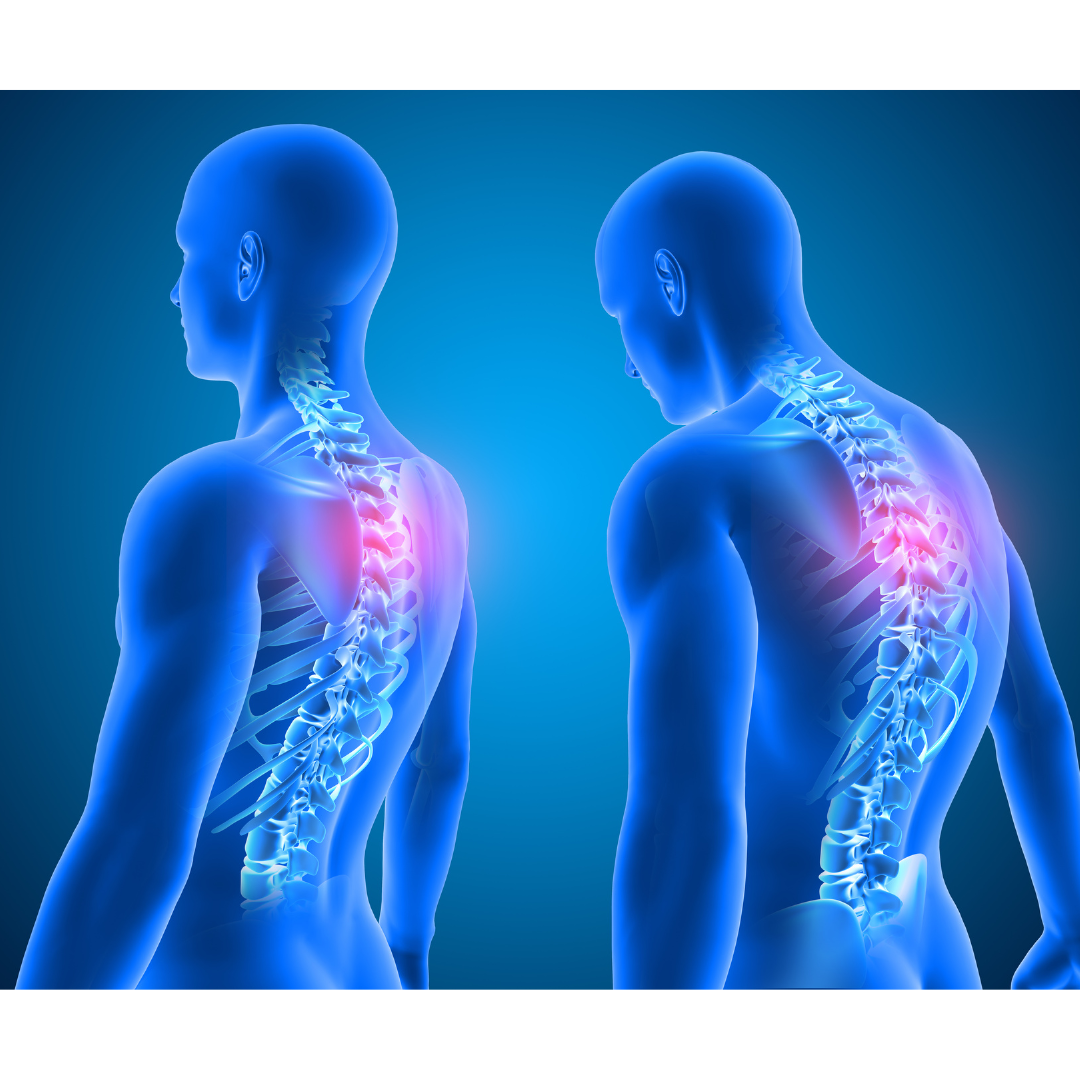 Sports chiropractic